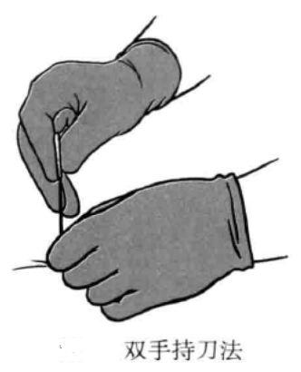 小针刀的持刀方法