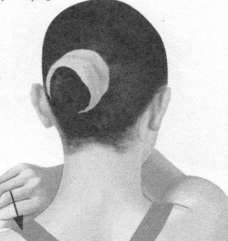 颈椎病按摩部位图解