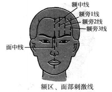 飞针技术额区刺激线