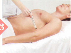 阴囊潮湿艾灸哪个部位图解