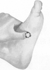 胃肠炎按摩部位图解