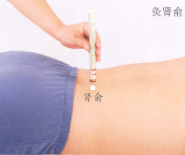急性腰扭伤艾灸哪个部位图解