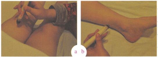 闭经艾灸哪个部位图解