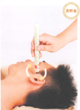 耳鸣-耳聋艾灸哪个部位图解