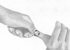 肥胖症按摩部位图解