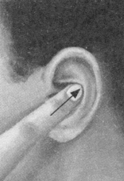 糖尿病按摩部位图解