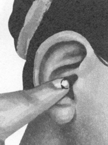 鼻炎按摩部位图解