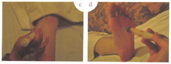 消除黑眼圈艾灸哪个部位图解