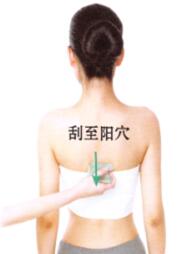 落枕刮痧部位图解