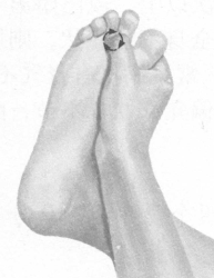 近视按摩部位图解