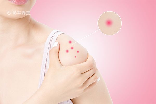 假疣和真疣的区别 假疣和真疣的区别在哪里