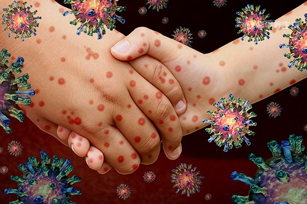 假疣和真疣的区别 假疣和真疣的区别在哪里