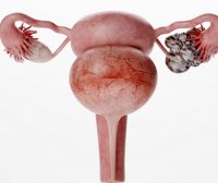 每个月都会排卵吗 排卵期症状