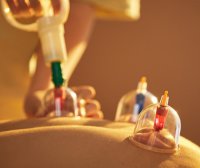 经常拔罐对身体的危害 拔罐的注意事项