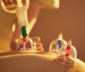 经常拔罐对身体的危害 拔罐的注意事项