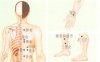 糖尿病刮痧部位图解