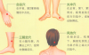 经期头痛艾灸哪个部位图解