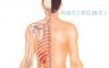 皮肤瘙痒按摩部位图解