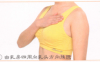 乳房肿块按摩部位图解