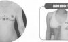 急性乳腺炎按摩部位图解