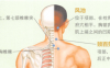 颈椎病艾灸哪个部位图解