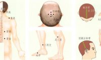 眩晕刮痧部位图解