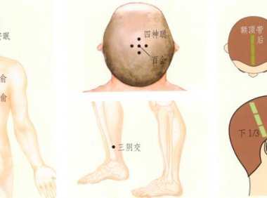 失眠刮痧部位图解