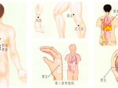 胃痉挛刮痧部位图解