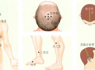 眩晕刮痧部位图解