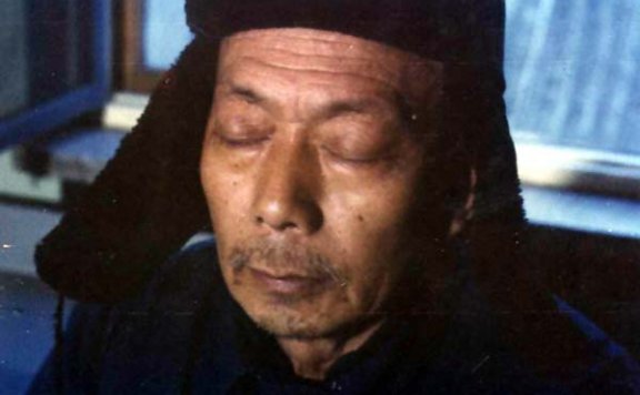 中医望目之目睛突起