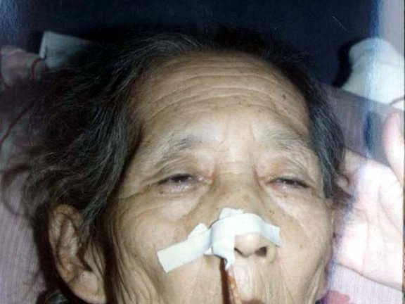 中医望神之目暗睛迷无神