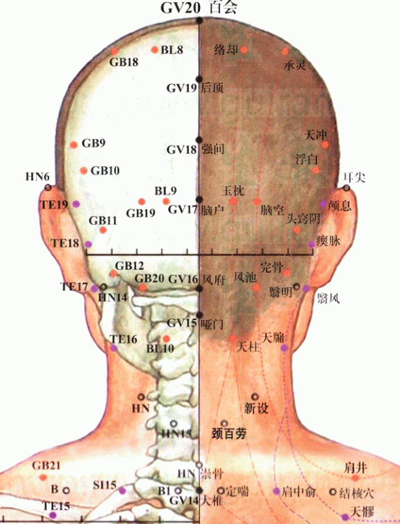 天柱