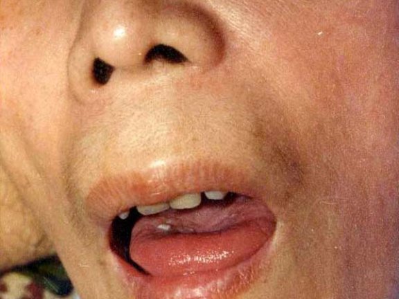 中医望神之少神