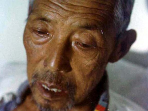 中医望色之面黑而浊