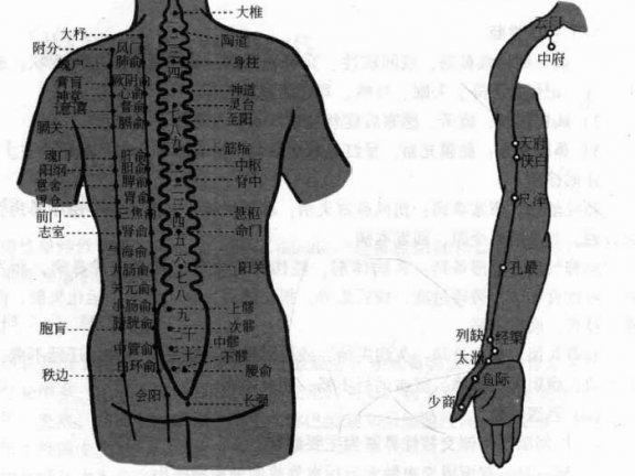 慢性单纯性鼻炎磁圆梅针疗法