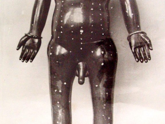 蒙医铜人（当代）