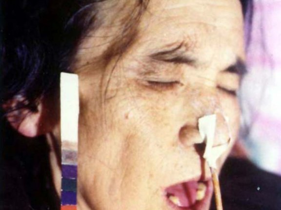 中医望色之面色淡白，舌红光莹